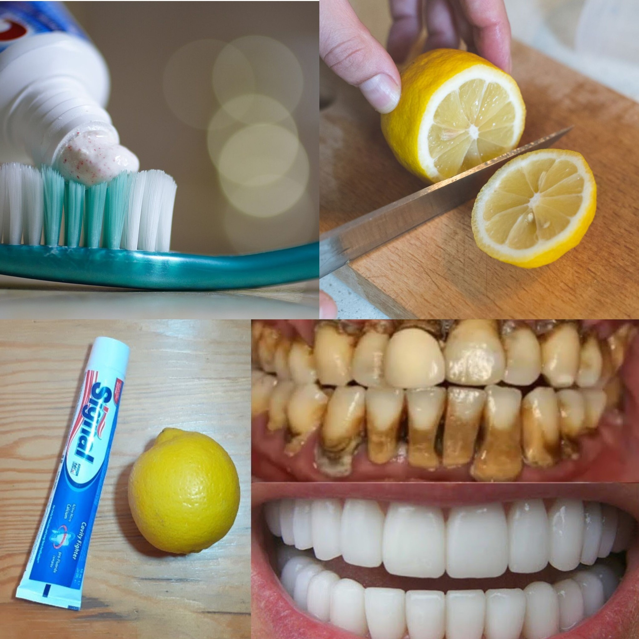 Brighten Your Smile: A Quick Method for Whitening Your Teeth at Home