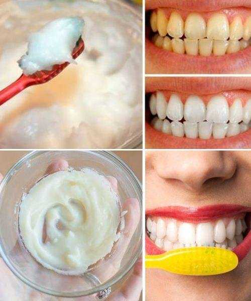 How to Naturally Whiten Your Teeth at Home in Just 3 Minutes Using Baking Soda and Coconut Oil