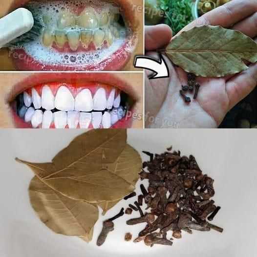 Achieving a Brighter Smile Naturally with Cloves and Bay Leaves