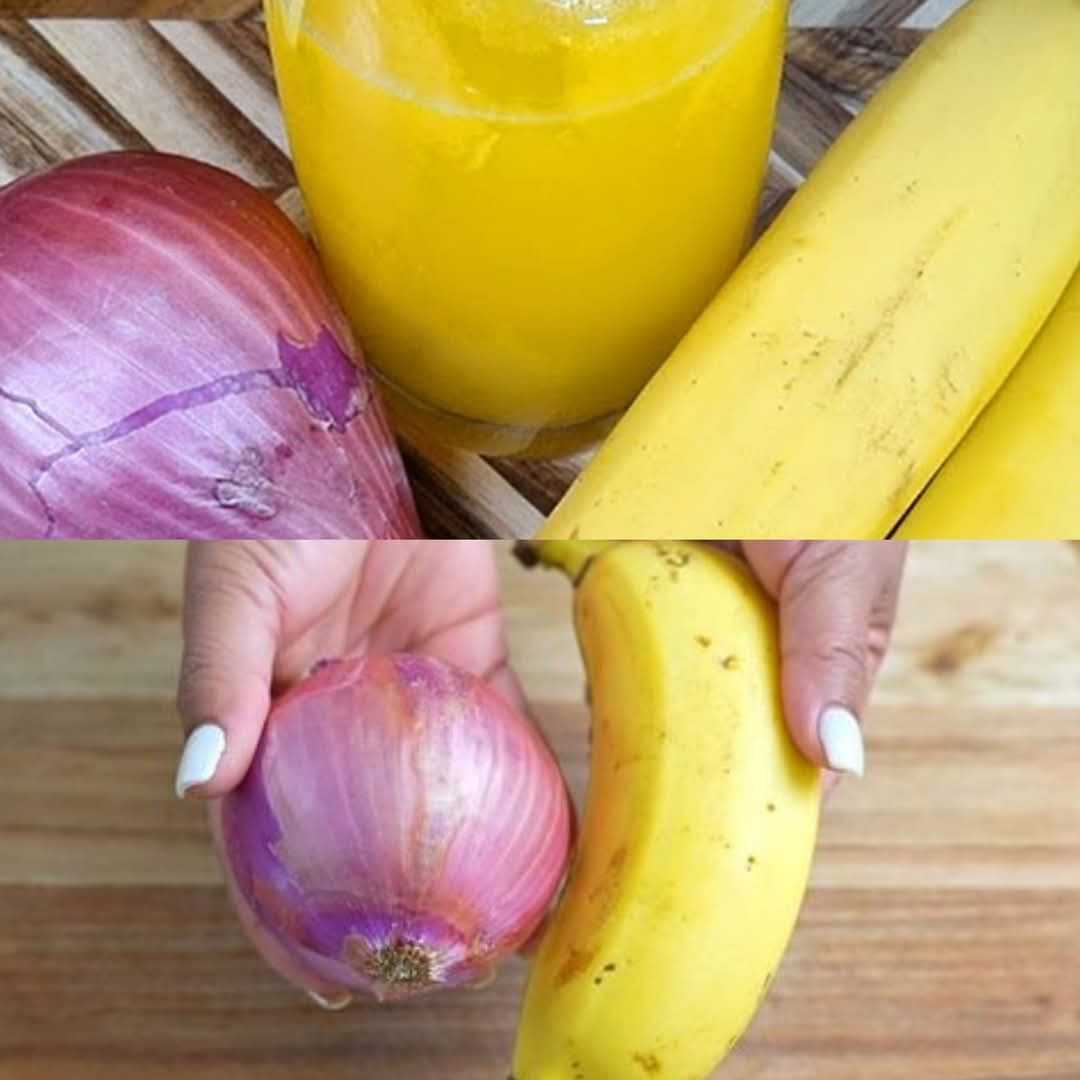 Relieve Joint Pain Naturally: Banana and Onion Remedy