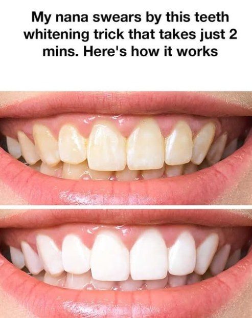 My nana swears by this teeth whitening trick that takes just 2 mins. Here’s how it works