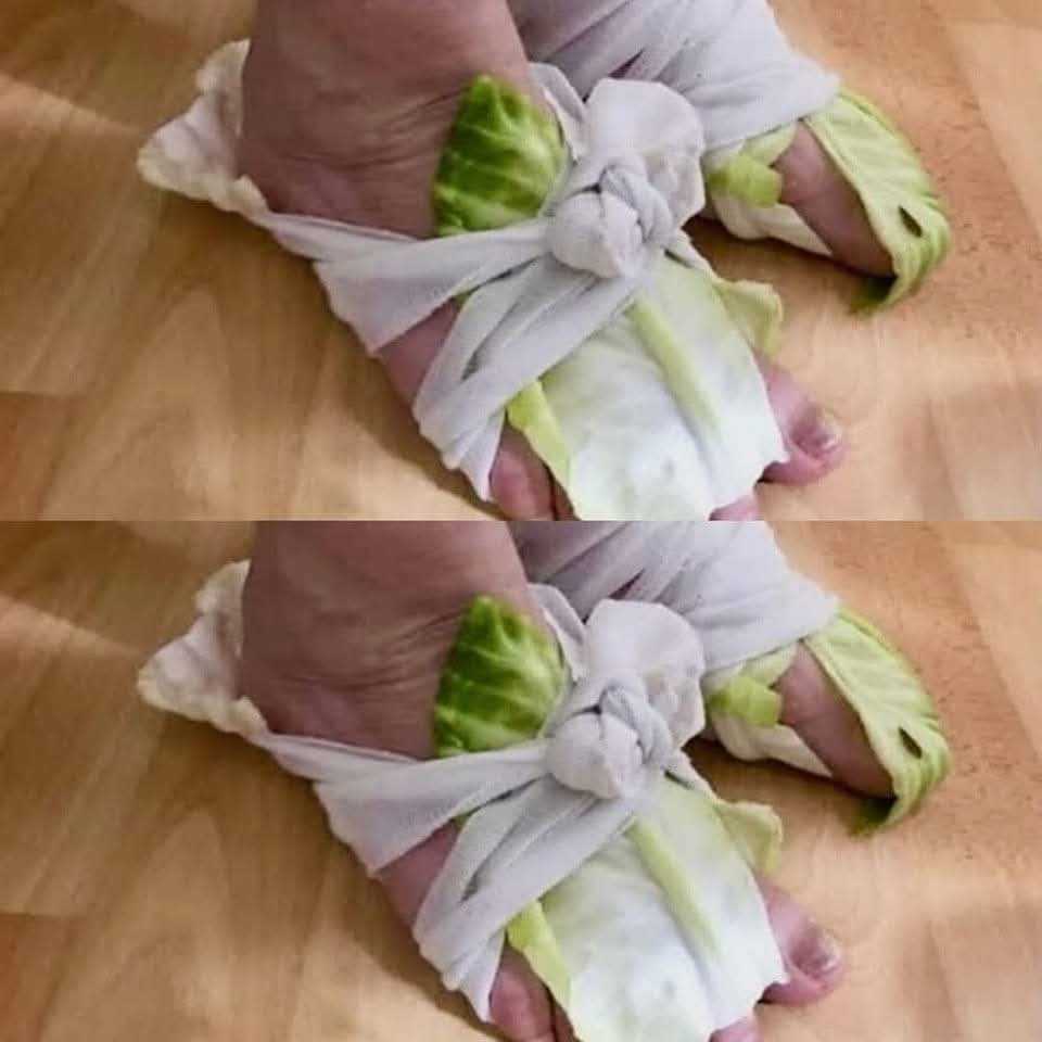 Cabbage Wraps: A Simple Remedy for Swollen Joints and Thyroid Issues