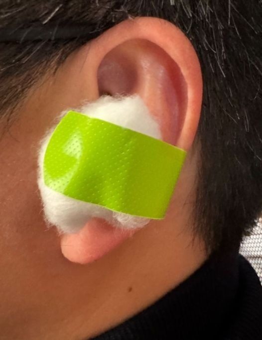 Put a cotton ball with VapoRub in your ear for a good result.