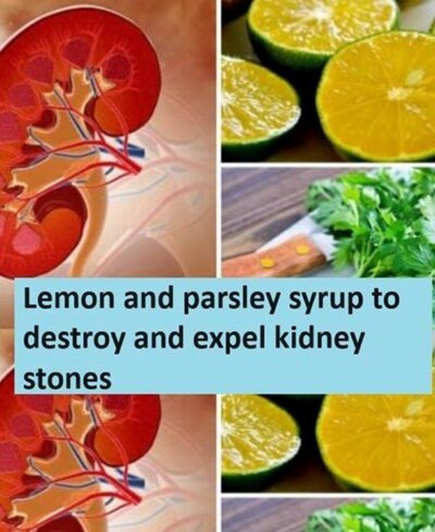 Lemon and Parsley Syrup for Kidney Stones