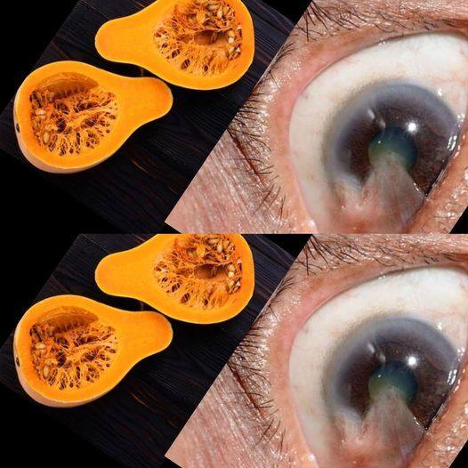 The Astonishing Benefits of Pumpkin for Vision: A Life-Changing Experience