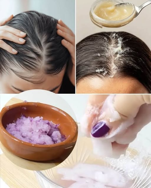 How to Use Vaseline for Hair Growth