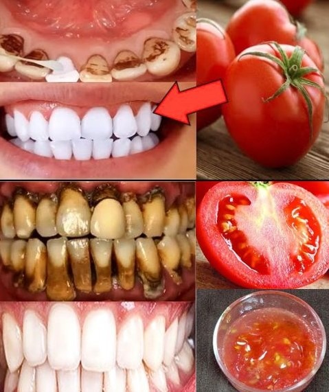 Brighten Your Smile Naturally: Tomato Teeth Whitening