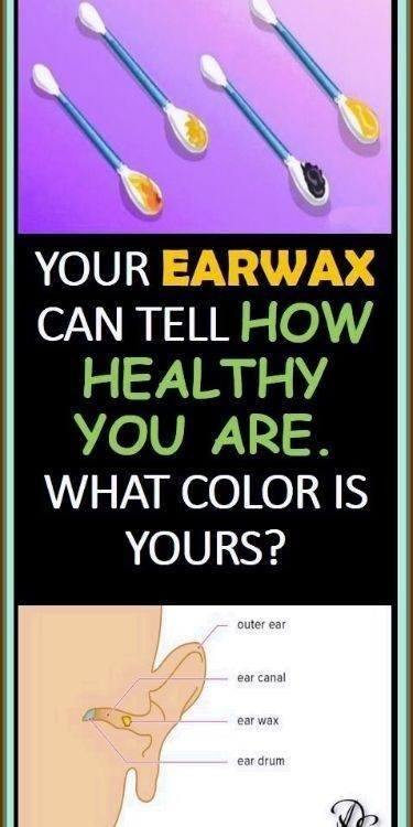 Your Earwax Can Tell How Healthy You Are. What Color Is Yours