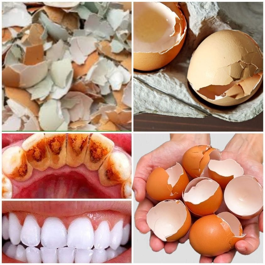 The Bright Smile Secret: Eggshell Teeth Whitening Wonder