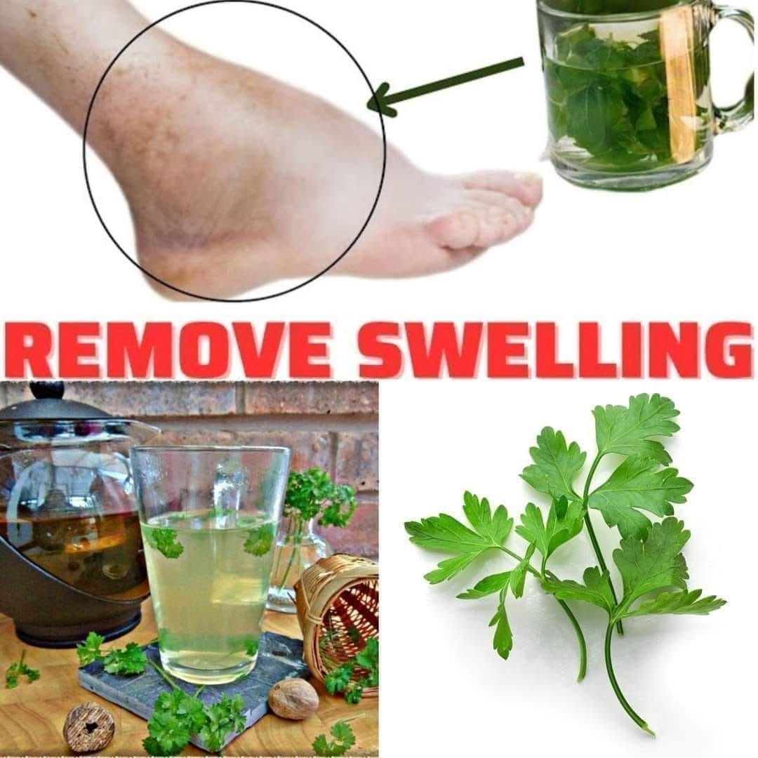 If You Drink This TEA You Will Quickly Remove the Swelling of Your Legs Ankles and Fe Parsley Tea