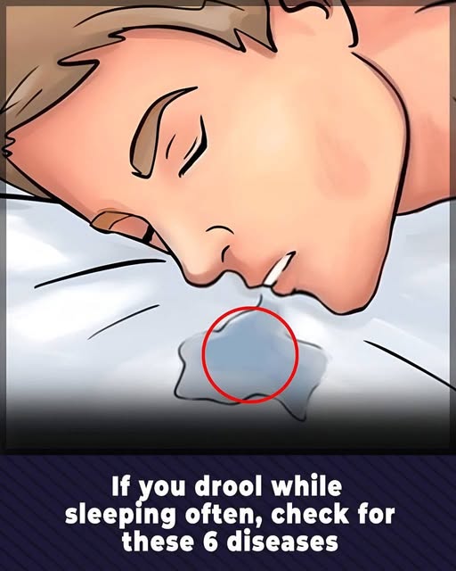 10 Reasons You’re Drooling While You Sleep and What It Could Mean