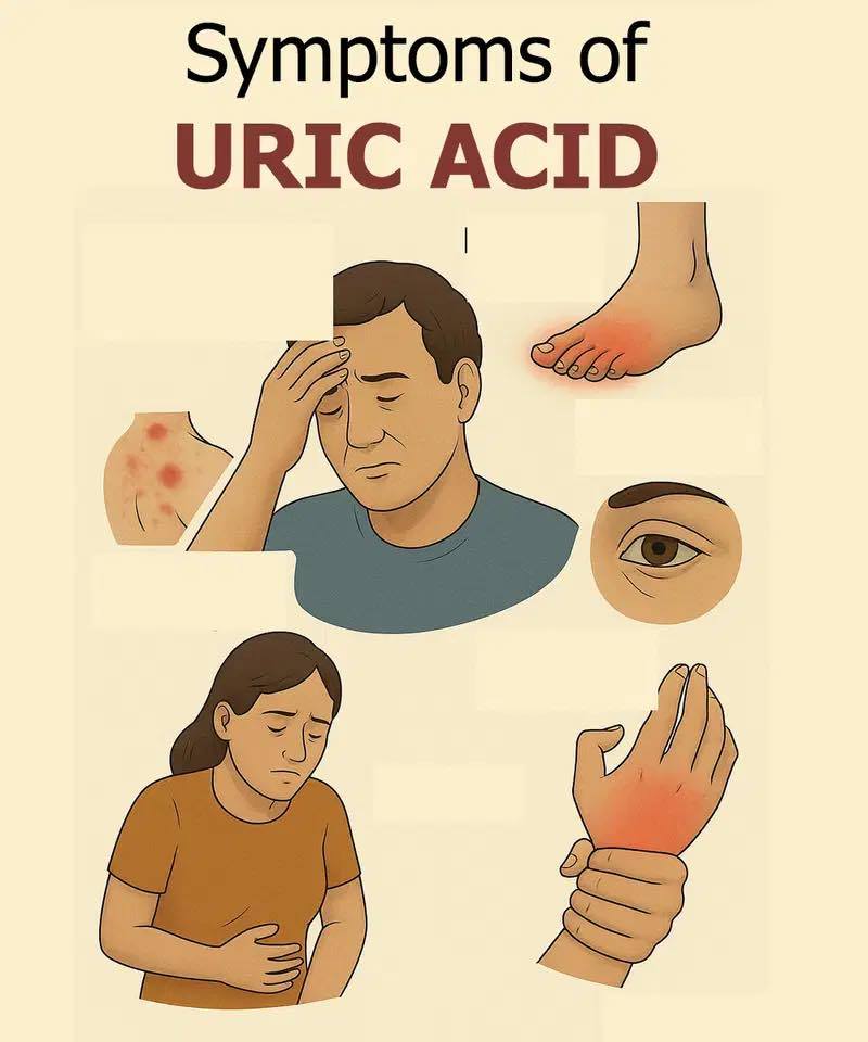 Foods to help control uric acid levels