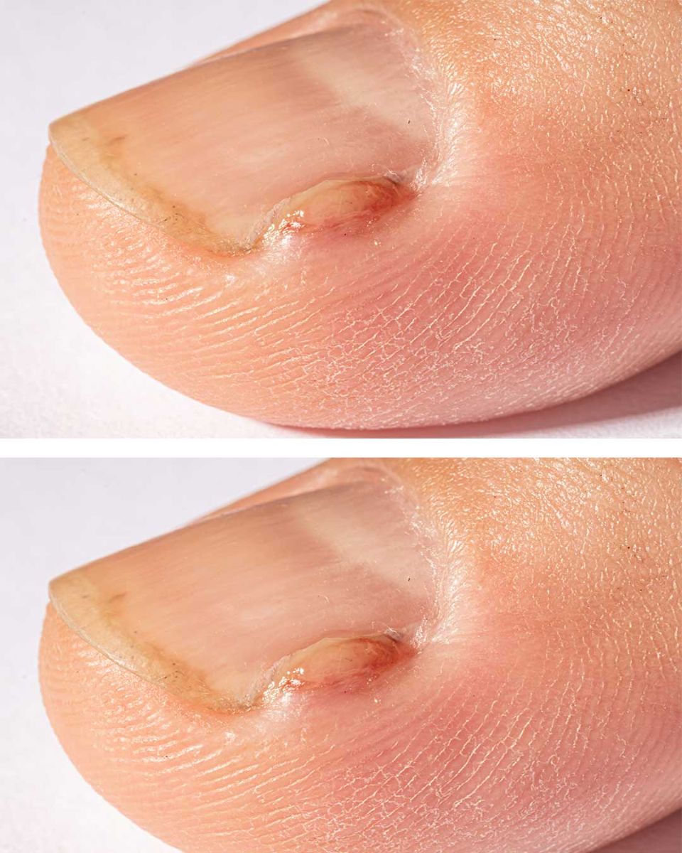 Got this painful spot near my big toe. Not sure what to do as doc appt isn’t soon. Any ideas?