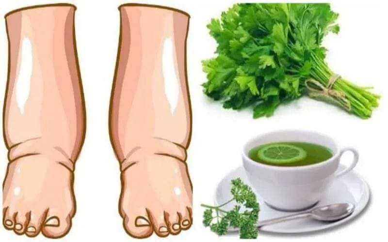 This Powerful Homemade Tea Heals Swollen Legs in Just Days