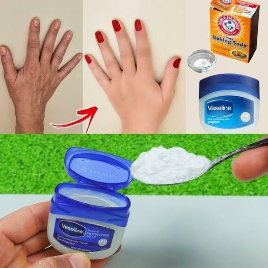 How I Keep My Hands Soft, Wrinkle-Free, Smooth, and Younger Looking! Vaseline and Baking Soda Hand Mask That Works!
