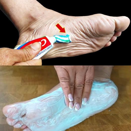 Toothpaste: The Secret to Happy Feet!