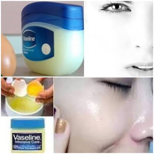 Look 10 Years Younger Naturally: The Amazing Benefits of Vaseline & Egg for Youthful Skin!