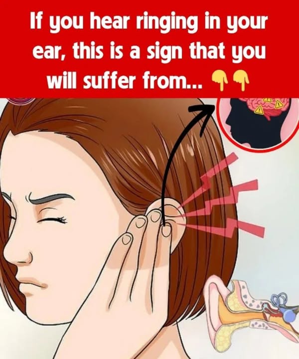 Meniere’s Disease: Symptoms, Causes, Treatment & Natural Remedies