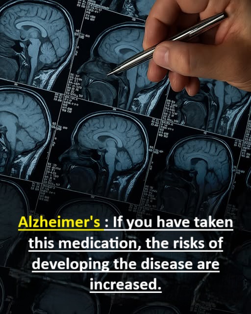 Alzheimer’s: 6 potential causes identified and ways to reduce their impact