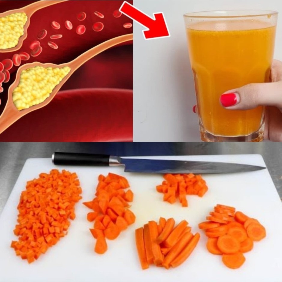 Title: The Magic Juice That Lowers Cholesterol: A Simple Remedy for Heart Health