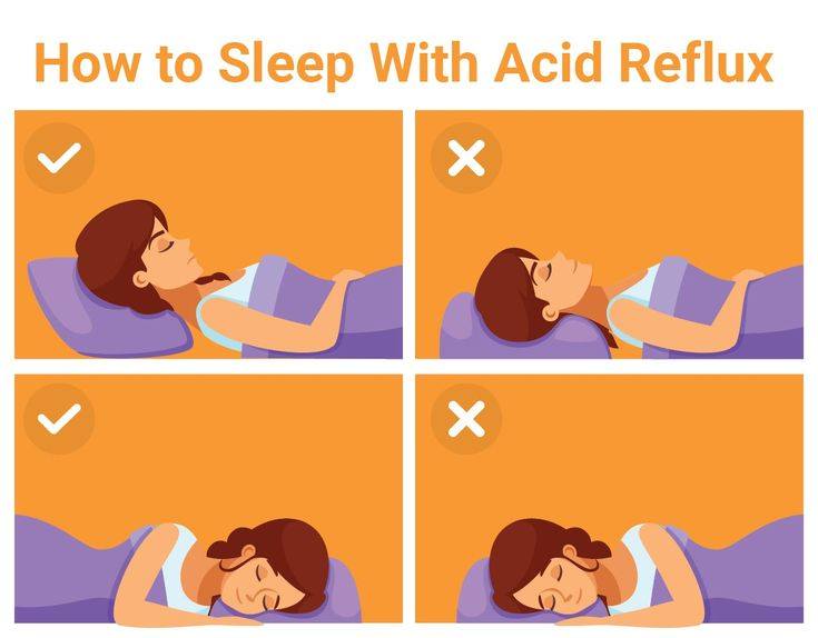 HOW TO SLEEP WITH ACID FEFLUX