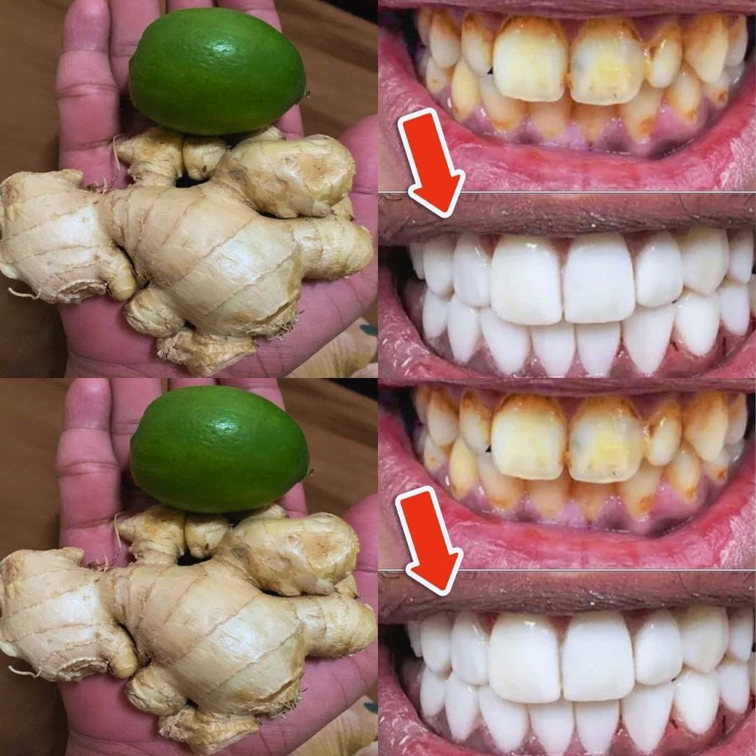 Say goodbye to stained teeth with this simple and effective method – results in just 2 MINUTES