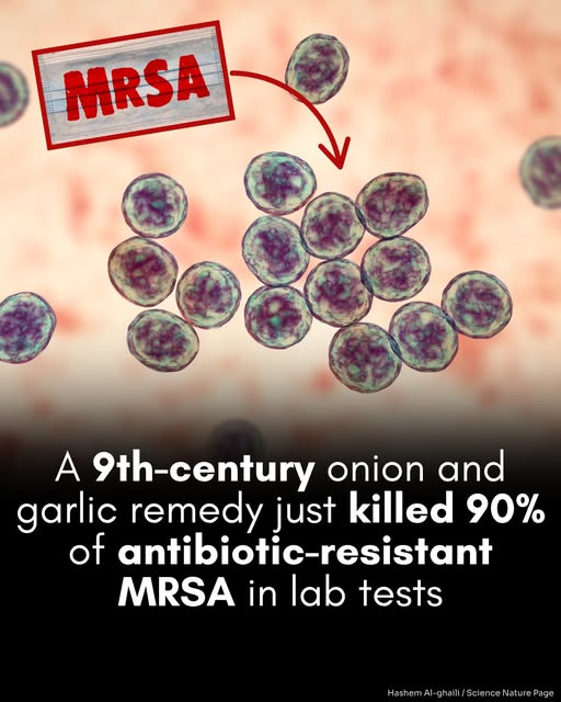 1,000-year-old onion and garlic eye remedy kills MRSA