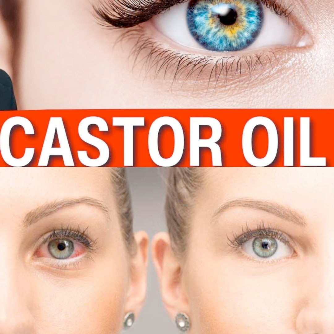 Advantages of Using Castor Oil for Healthy Eyes